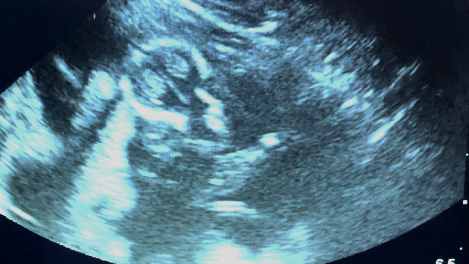 Ultrasound reveals ultra good news for tiger Zayana